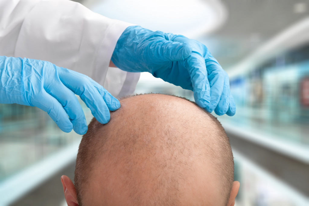 hair loss treatment for men