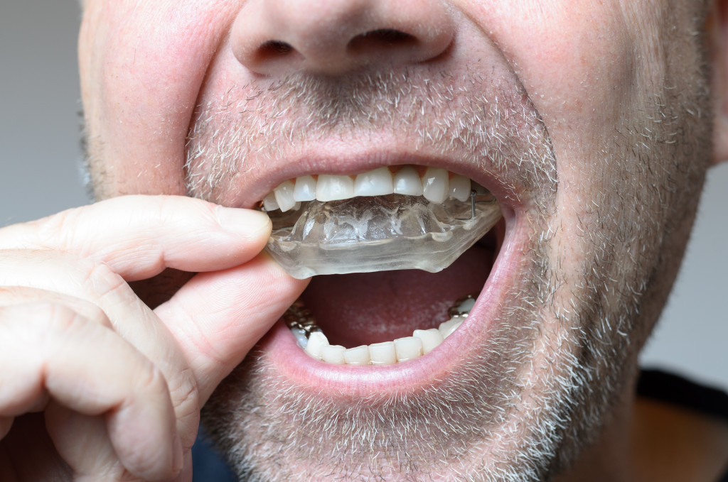 a male patient holding a splint to the roof of mouth